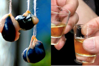Nhiễm độc gan vì … uống mật